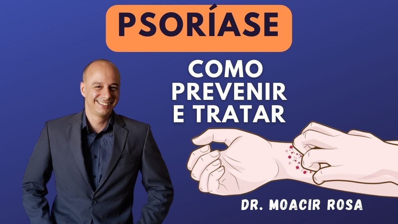 PSORÍASE: Como Prevenir e Tratar || Dr. Moacir Rosa