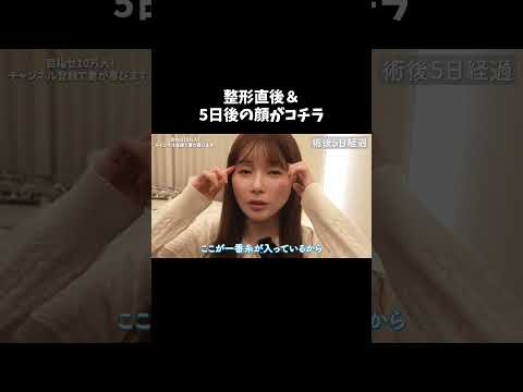 女医の整形直後&rarr;5日のリアルすぎる結果がこちら&hellip;！ #ゆりこ先生 #shorts