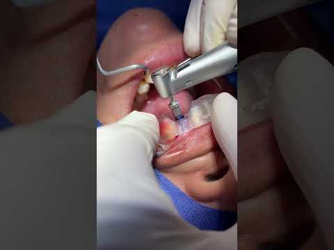 Agustin Salamanca Tapia-34