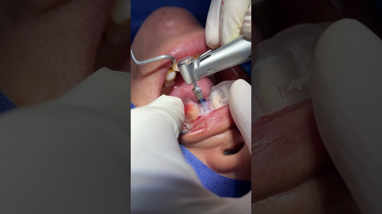 Agustin Salamanca Tapia-33