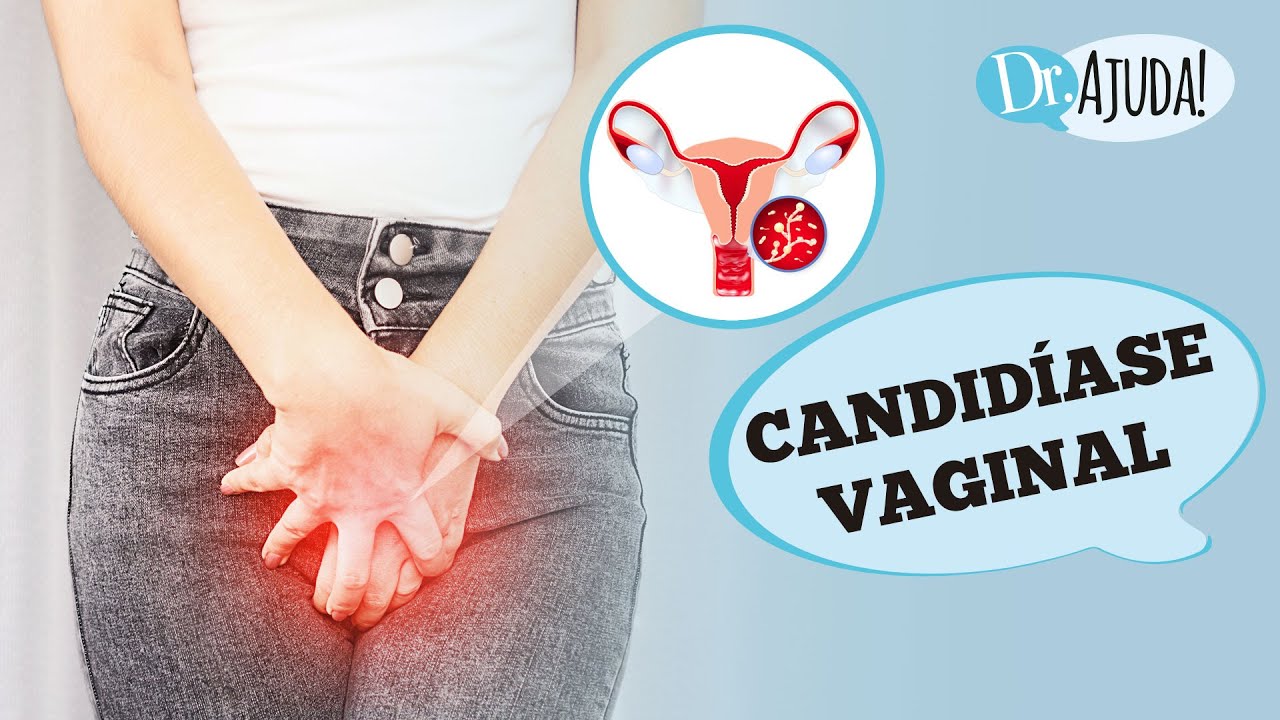 CANDIDÍASE VAGINAL: O QUE É, SINTOMAS, DIAGNÓSTICO, TRATATAMENTO E PREVENÇÃO
