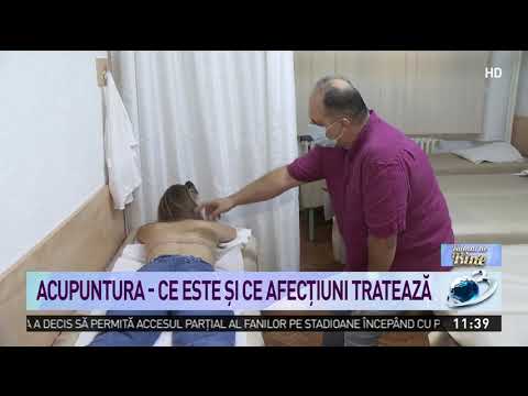 venele vizibile pe picioare nu sunt varicoase