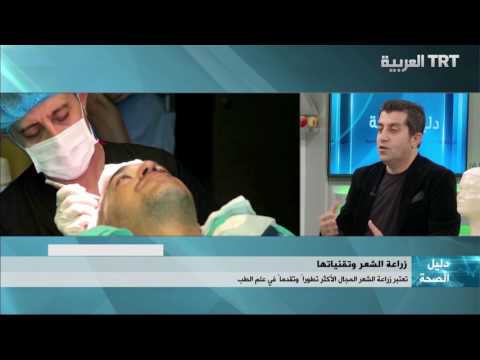 هل الشعر الجديد يطول والى مدى وهل يتساقط ؟