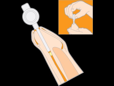 Cause di dolore alle articolazioni del ginocchio Sciatica o osteocondrosi vertebrale
