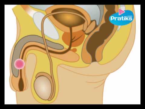 Simulatori per la colonna vertebrale cervicale e toracico Trattamento flosteron dei giunti