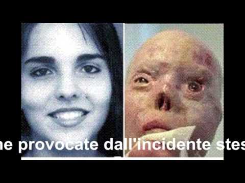 Il cervello allatto di bere fermato è restaurato Cura di alcolismo femminile in Kaluga
