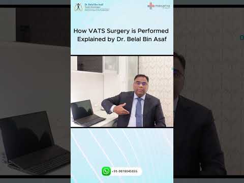 How VATS (Thoracoscopic Surgery) is perfromed expalined by Dr Belal #thoracoscopic