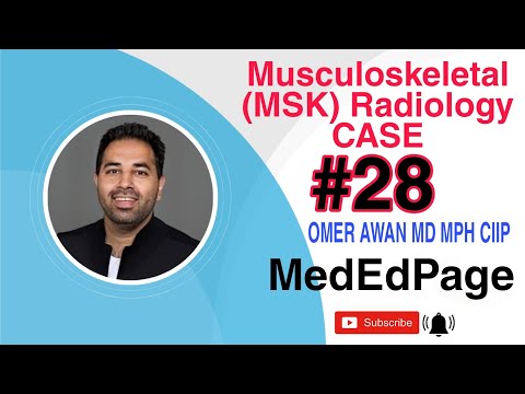 Musculoskeletal (MSK) Radiology CASE #28