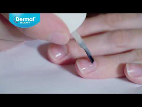 FUNGISTOP 3-IN-1 NAIL TREATMENT - NZ