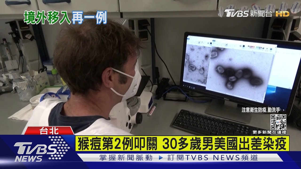 猴痘第2例叩關 30多歲男美國出差染疫
