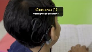 कॉक्लियर इम्प्लांट;?>