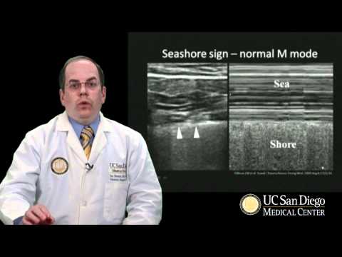 Ultrasound and the Acute/Trauma Surgeon - J. Doucet, MD