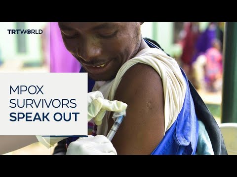 Video | Sierra Leone's mpox survivors face new battle against stigma