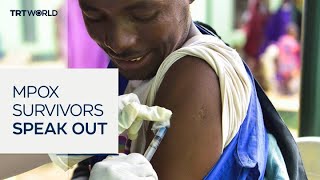 Sierra Leone's mpox survivors face new battle against stigma