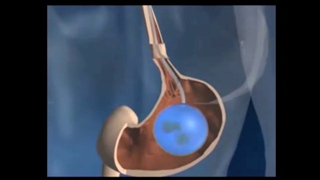 Azucena Reyes Pérez-11