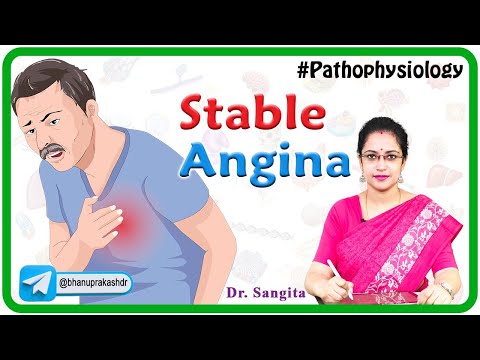Stable Angina: Causes, Pathophysiology, Symptoms, Diagnosis and Treatment ( Internal medicine )