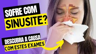 MELHOR EXAME PARA DIAGNÓSTICO DE SINUSITE Raio -x, tomografia , nasofibroscopia , ressonância