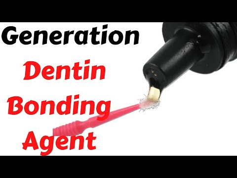 Enamel & Dentin Bonding Agent- Classification, #Generation , Lecture- Adhesion in Dentistry in Hindi