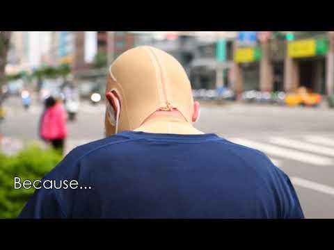 Rehabilitation for burn survivors in Taiwan