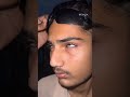 Viral Moya Moya Comedy