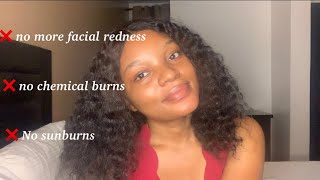 How to prevent and treat facial redness and sunburns/chemical burns