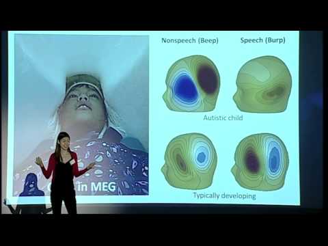 Shu Hui Yau - Trans-Tasman 3-minute thesis finals
