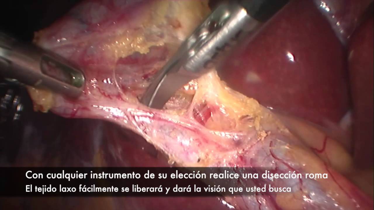 Jose Francisco Castro Castro-7