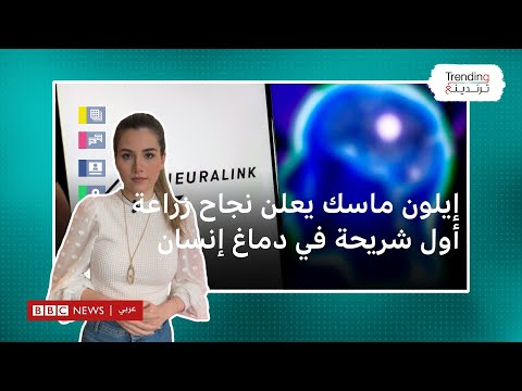إيلون ماسك يعلن زراعة أول شريحة إلكترونية في دماغ بشري من شركة نيورالينك.. فما مقدار الاستجابة؟