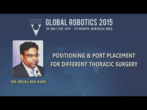 Positioning and Port Placement for Different Thoracic Surgery