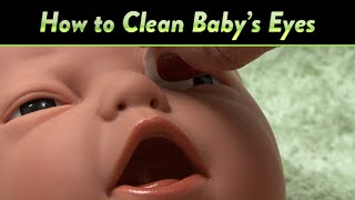 How to Clean Baby's Eyes and Clogged Tear Ducts | CloudMom