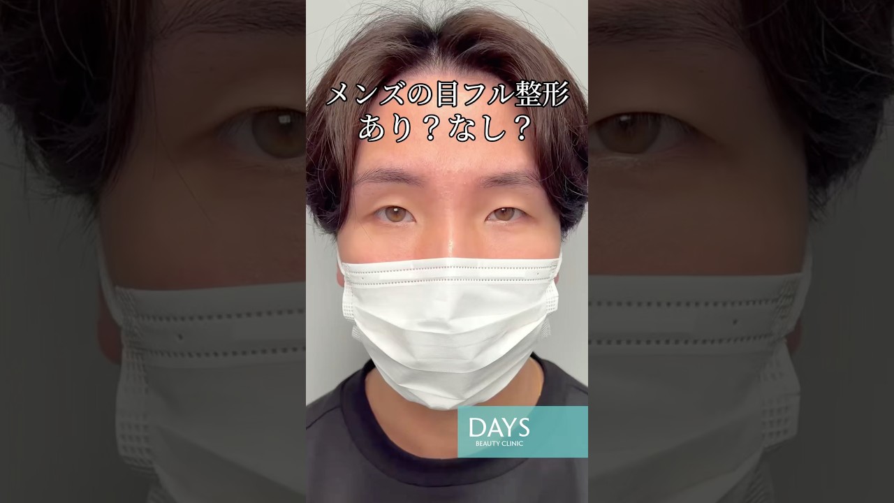 【目フル整形】衝撃のビフォーアフター！#shorts