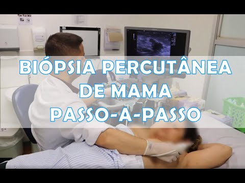 Biópsia percutânea de fragmento de nódulo de mama guiada pela ultrassonografia