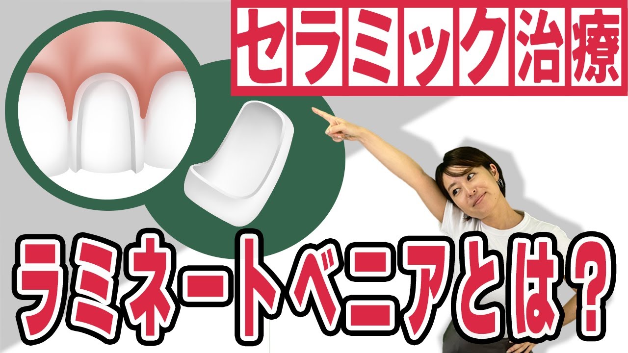 【審美歯科治療】ラミネートべニアとは?【セラミック治療】【前歯】