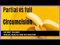 Partial Vs Full Circumcision Explained