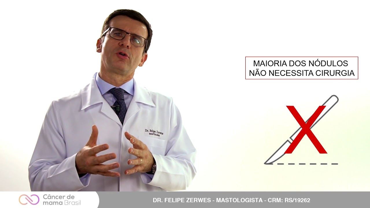 NÓDULOS MAMÁRIOS BENIGNOS