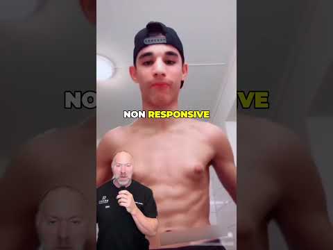 Gynecomastia Isn’t About Weight ❌ #shorts