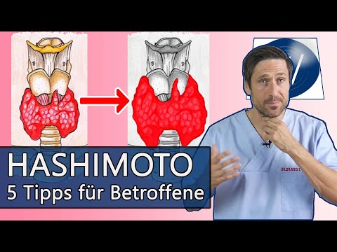 Probleme mit Hashimoto & der Schilddrüse? Dinge auf die Sie unbedingt achten sollten: Meine 5 Tipps!