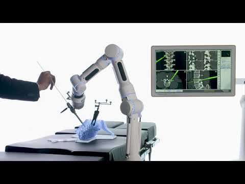 CIRQ System - How It Works