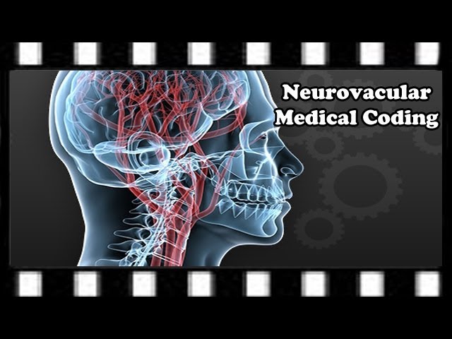 הגיית וידאו של cerebral angiography בשנת אנגלית