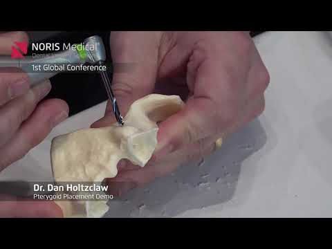 Pterygoid Placement Demo