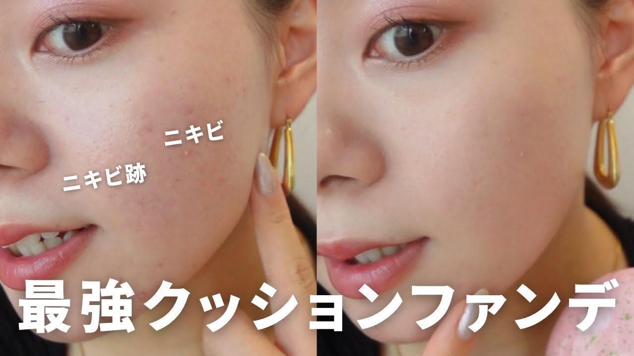 【肌荒れ】ニキビ跡が薄くなったように自然に隠せる最強クッションファンデ！【ベースメイク】