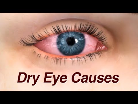 Dry Eye Causes and Treatment