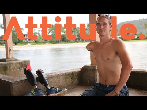 Surviving a Triple Amputation: Cameron’s Story