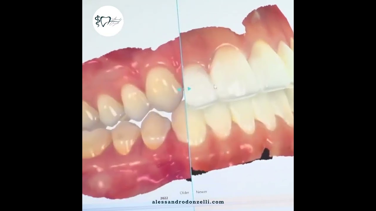 Alessandro Donzelli-20