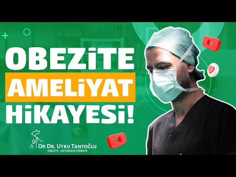 Obezite AmeIiyatı HİKAYESİ | Tüp Mide Ameliyatı Yurt Dışı Hastamız