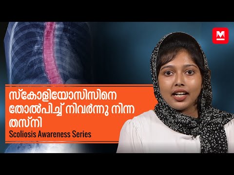 Scoliosis Awareness Series