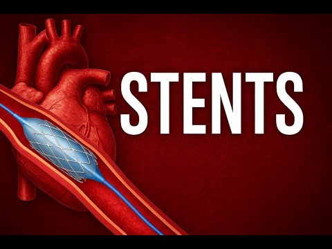 Stents: The Tiny Tubes Saving Millions of Lives