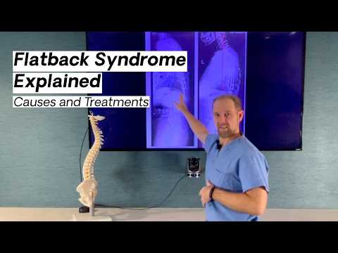 Flatback Syndrome Explained by a Spine Surgeon | VSI