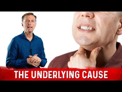 Burning Throat Syndrome or Silent Acid Reflux Causes – Dr.Berg