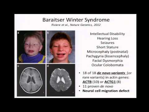 GM4: Cincinnati Children's Hospital Genomic Medicine Integration Efforts - John Harley